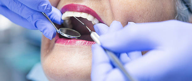 Best Emergency Broken Tooth Repair in Russell, GA