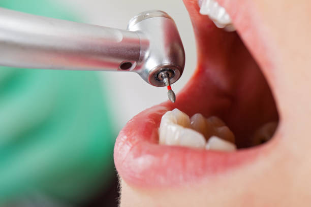 Best Emergency Treatment for Toothache in Russell, GA
